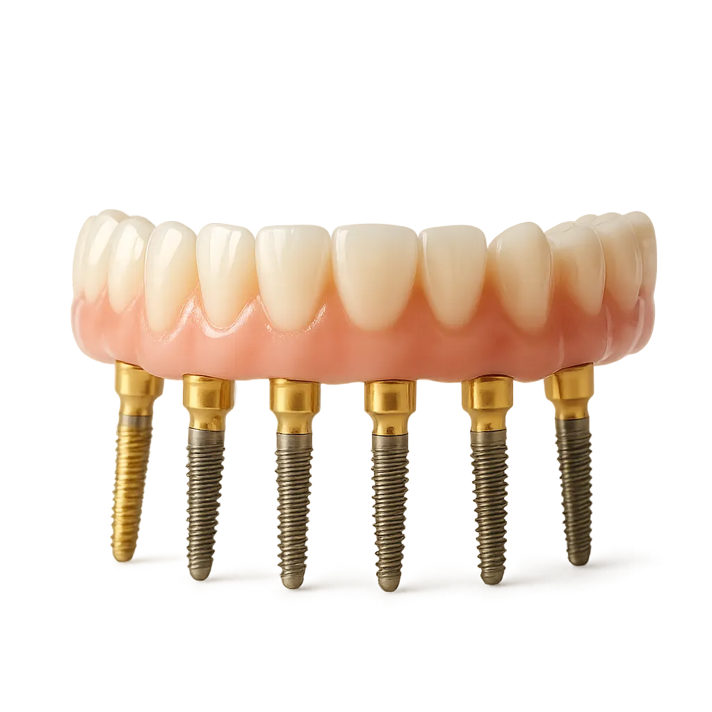 Clinical view of an All-on-6 implant structure