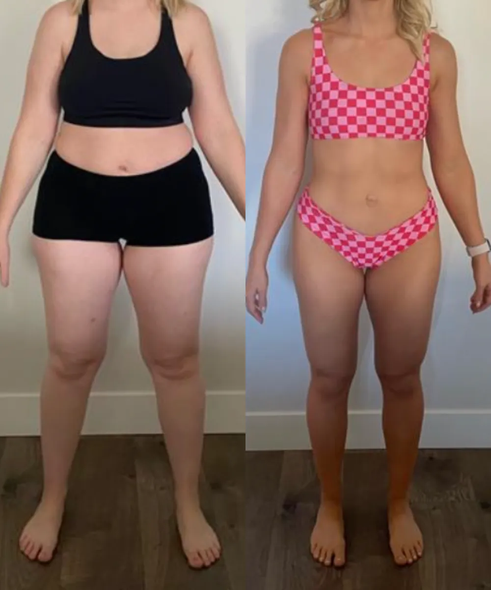 Mara - Before and After