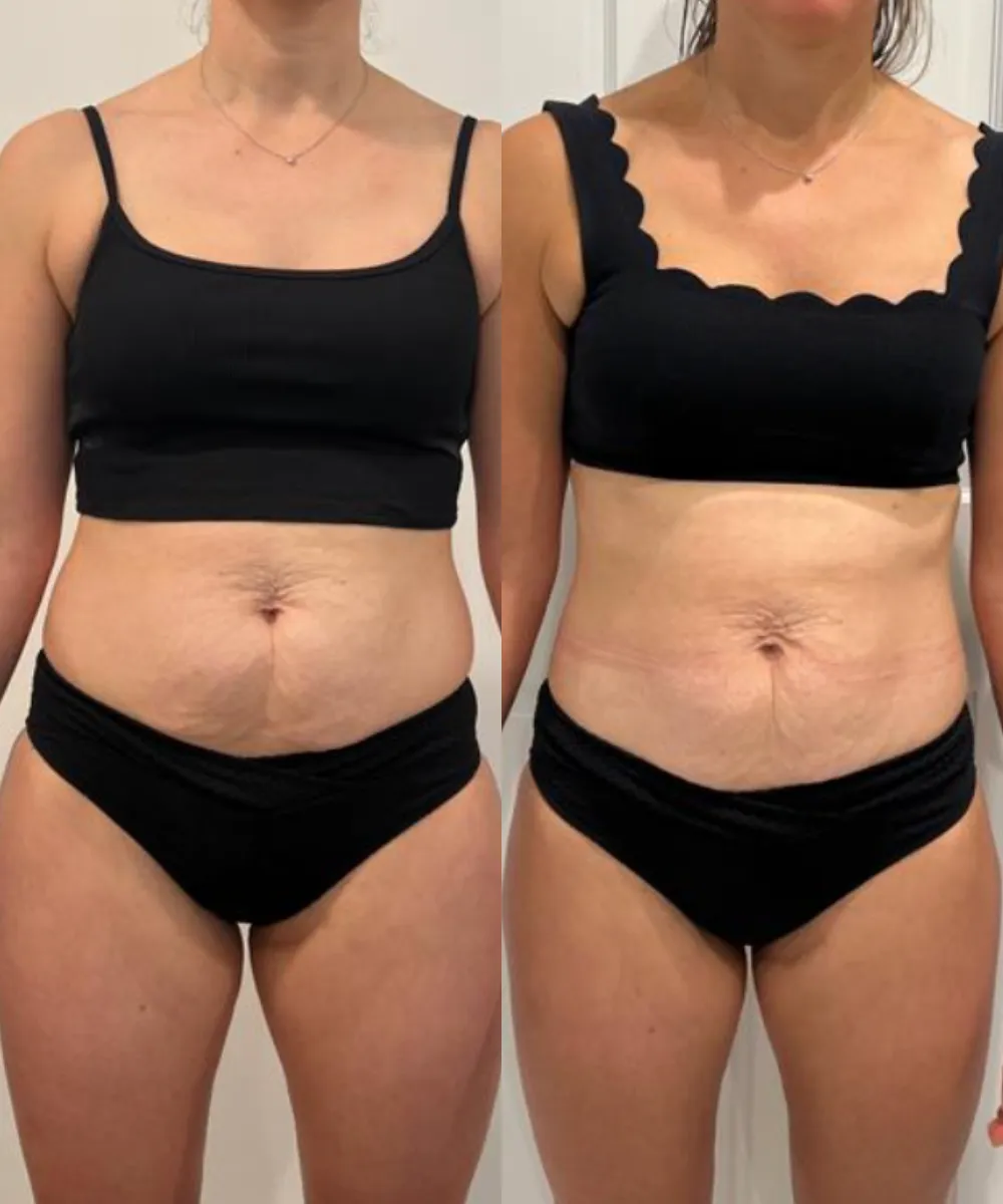 Evie before and after