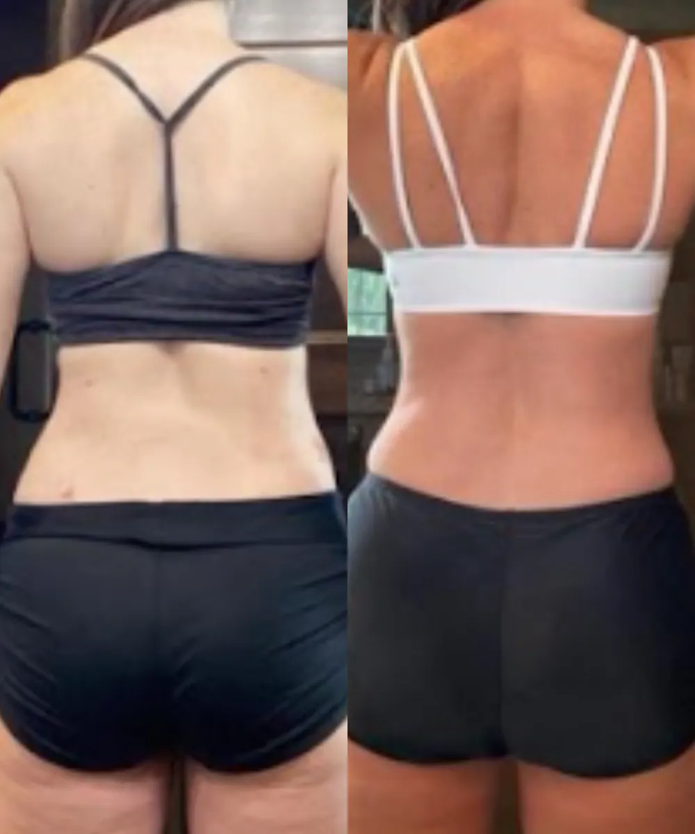 Joelle Before and After