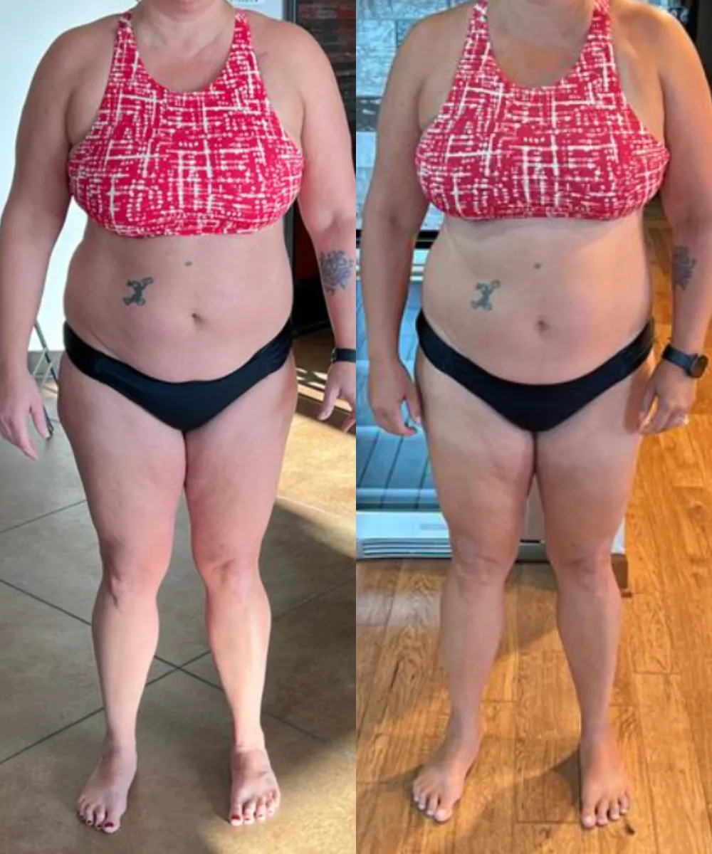 Cheryl Before and After