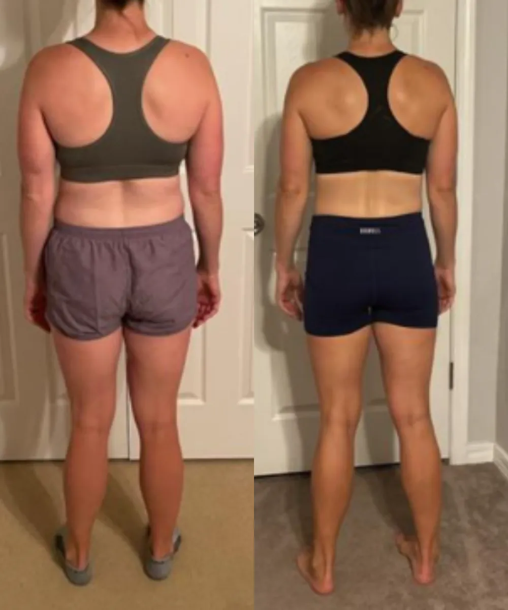 Michelle before and after