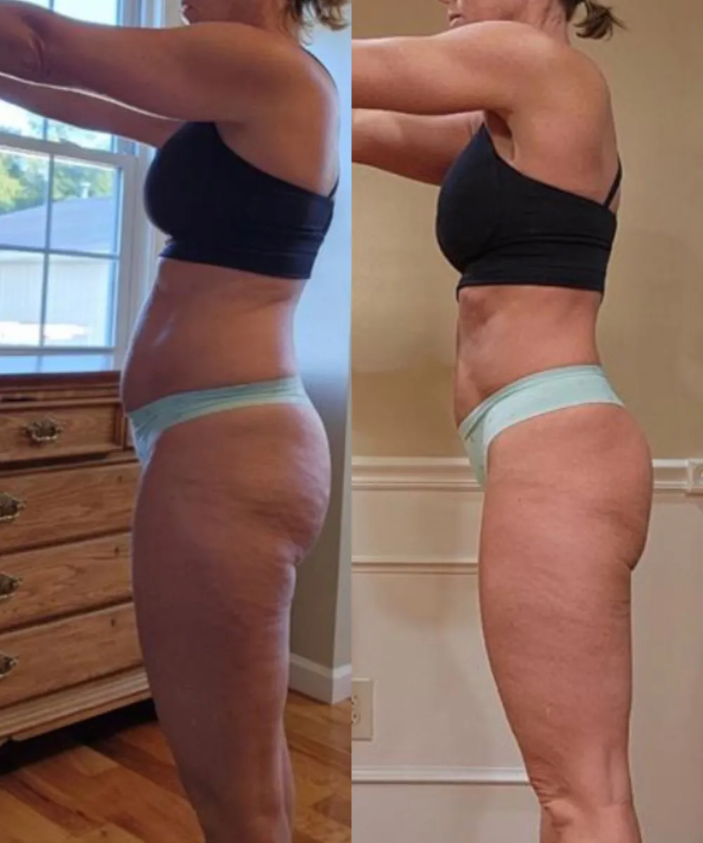 Amy Before and After