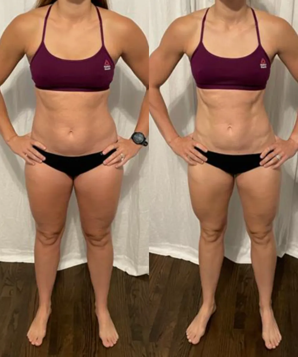 Lindsey Before and After