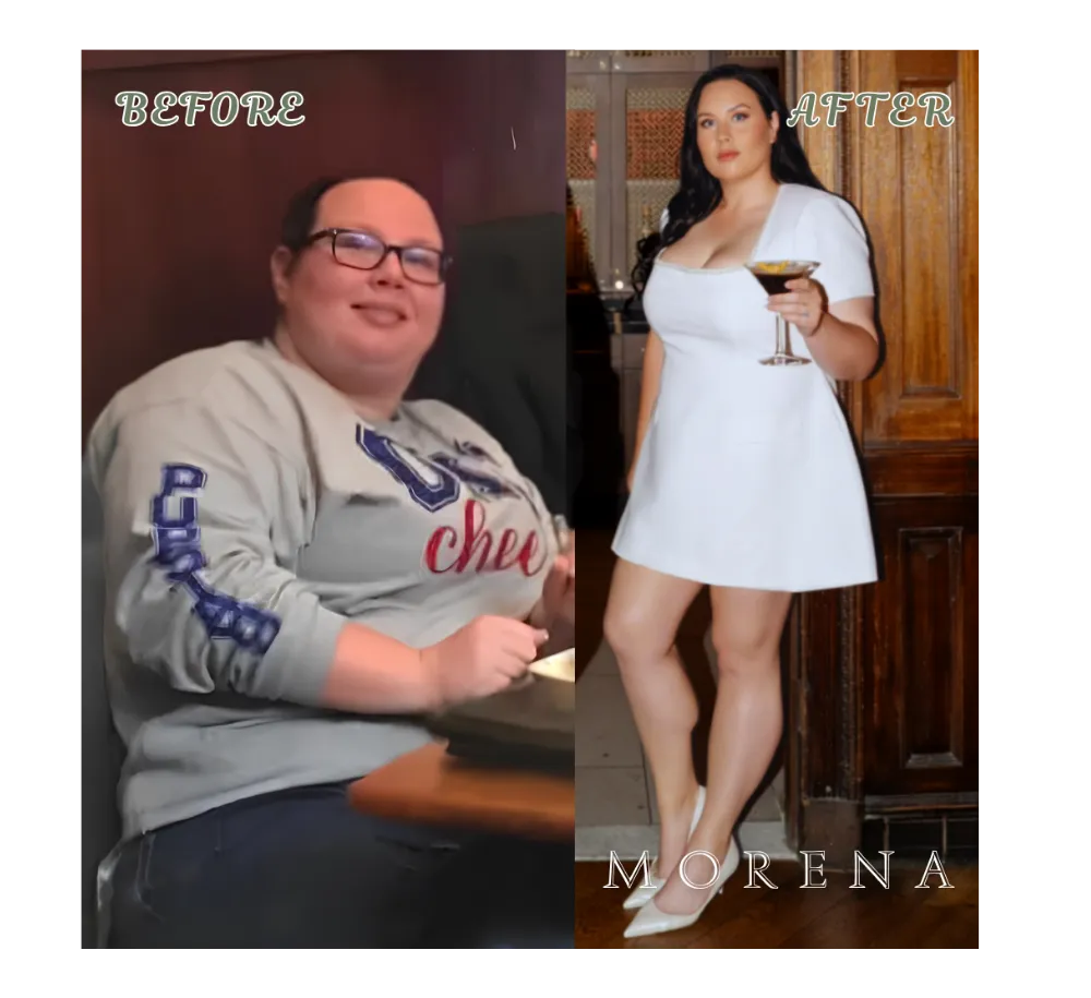 Medical Weight Loss Before and After Result