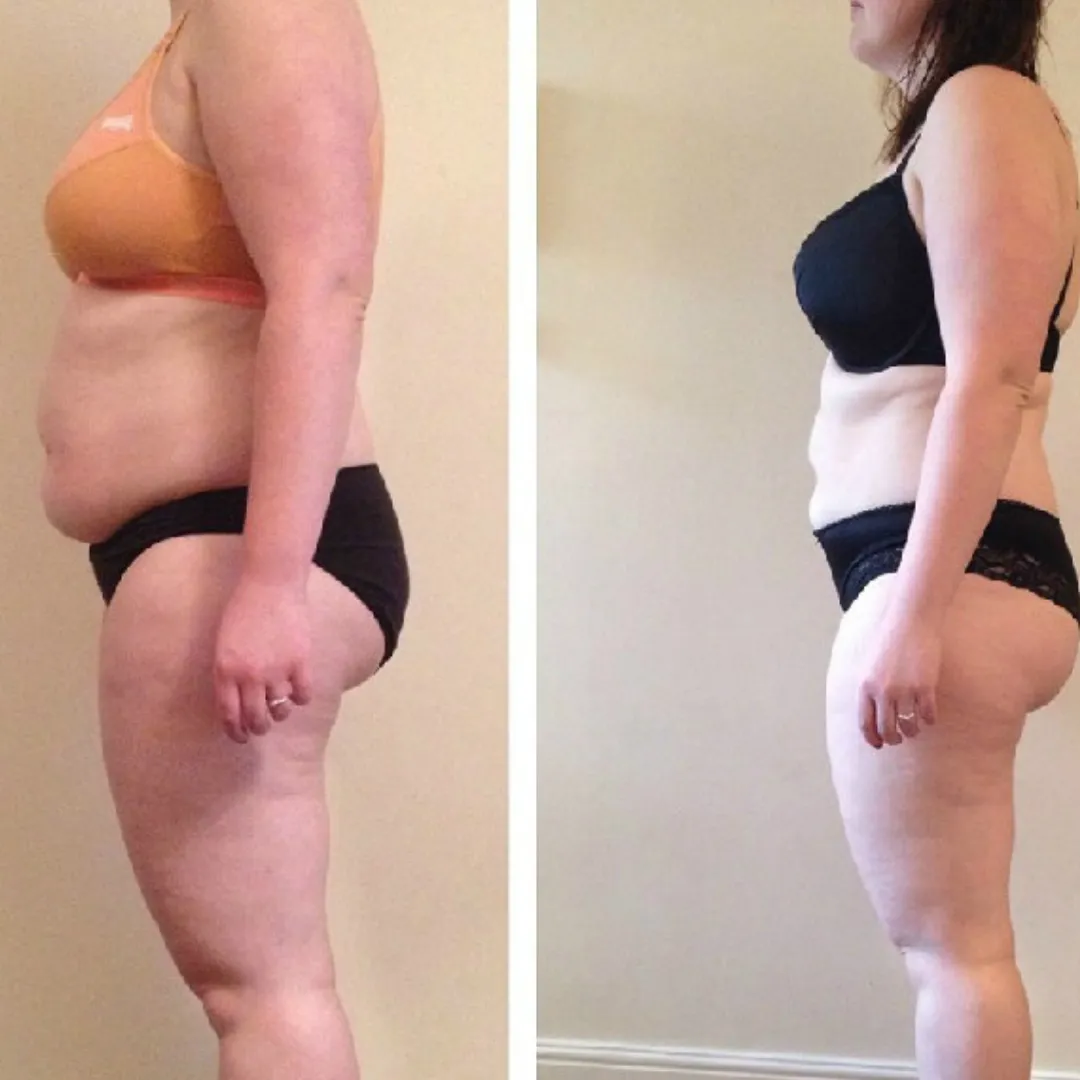 Client transformation