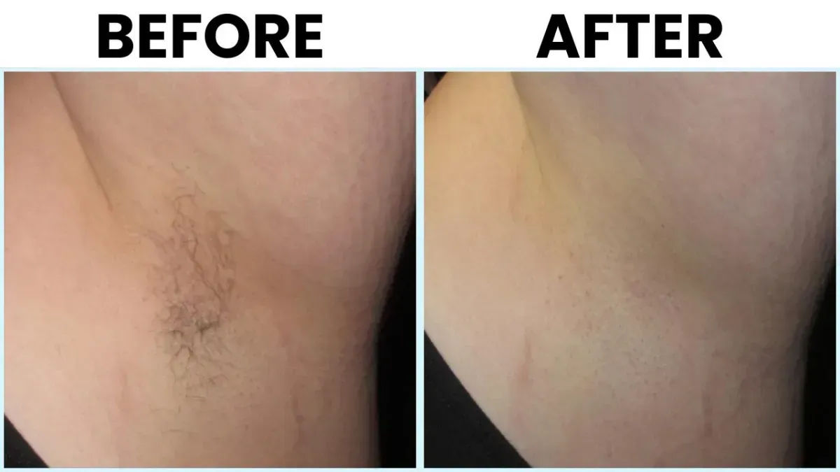Before and After 1
