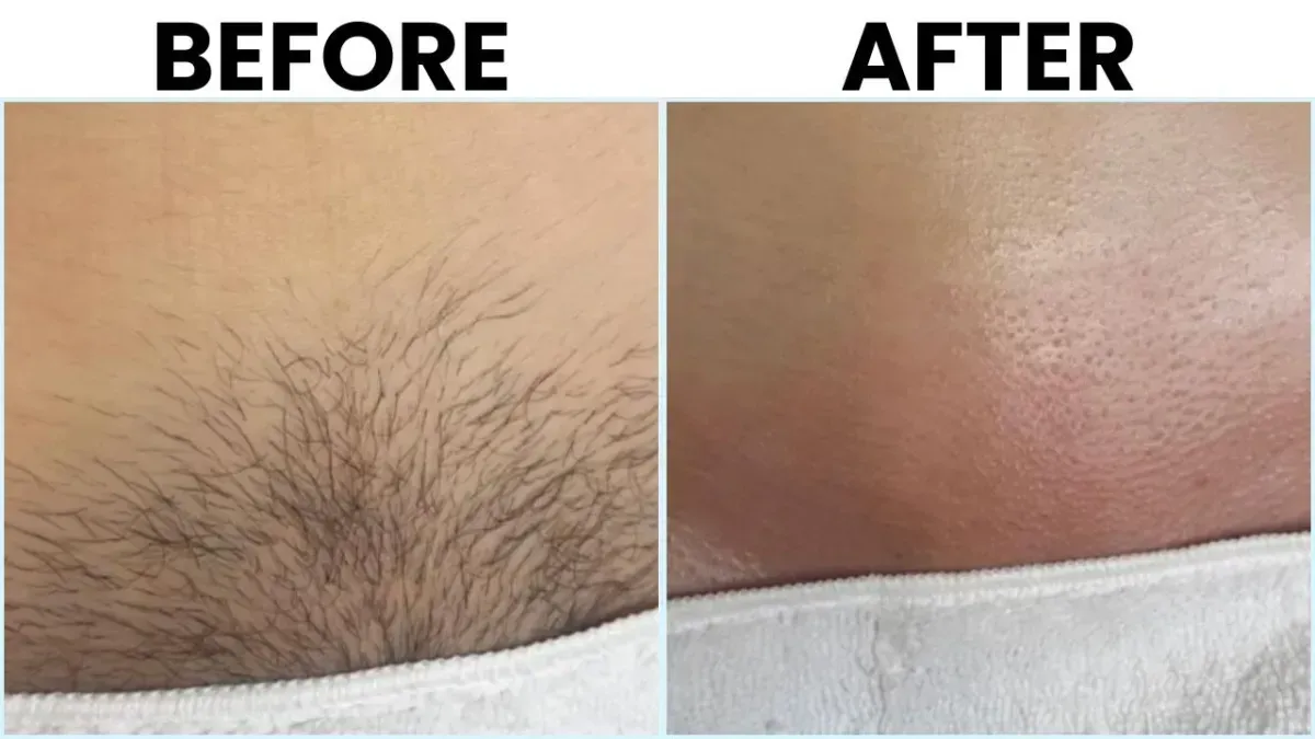 Before and After 2