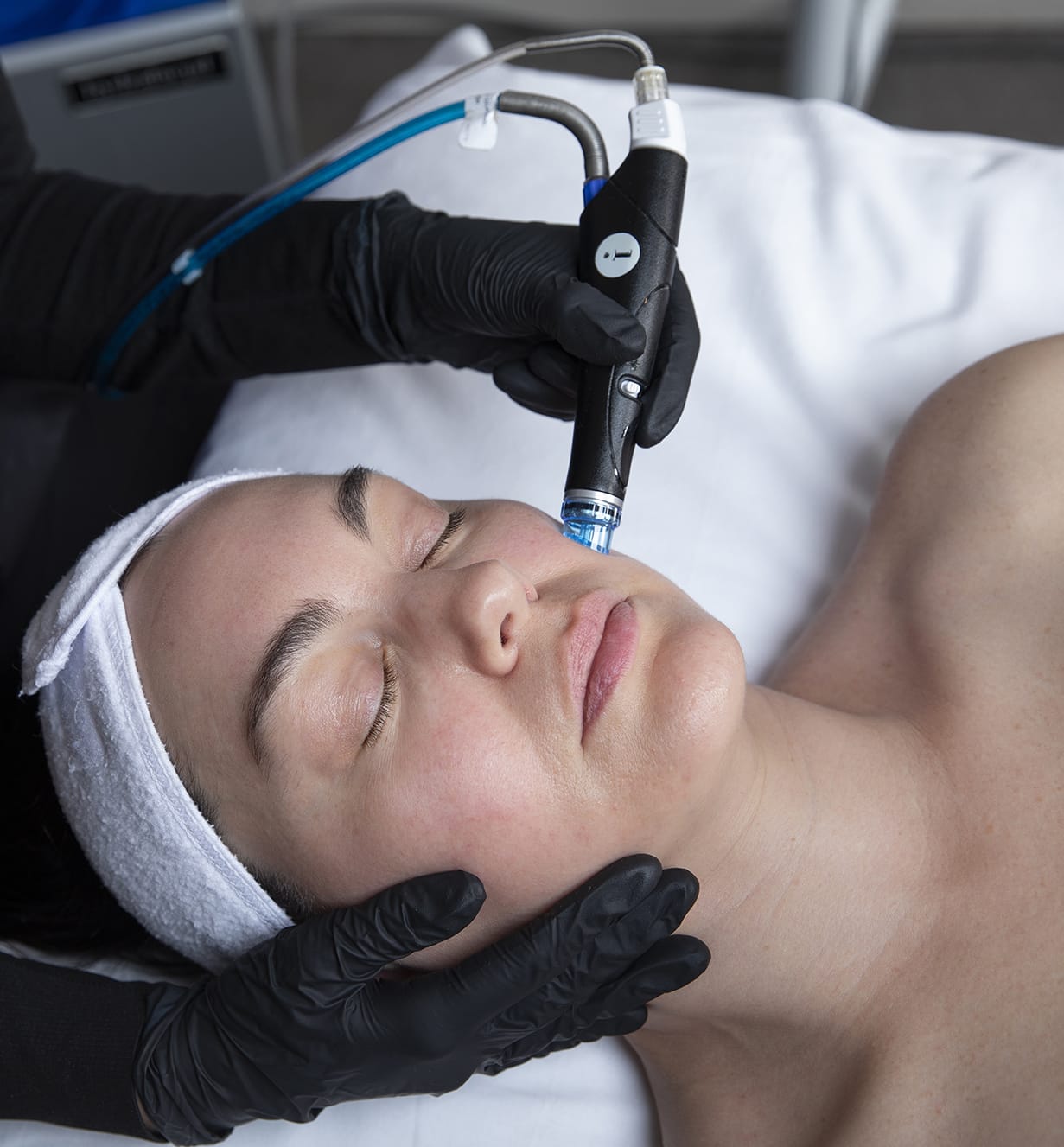 Hydrafacial Treatment