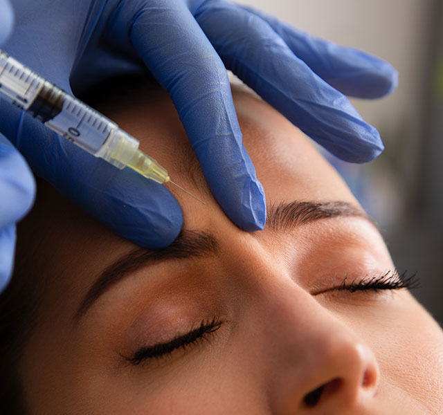 Aesthetic injectable treatment with syringe and needle on forehead for wrinkle reduction.