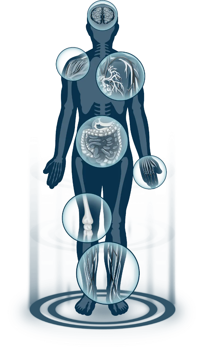 Human body diagram showing symptom areas