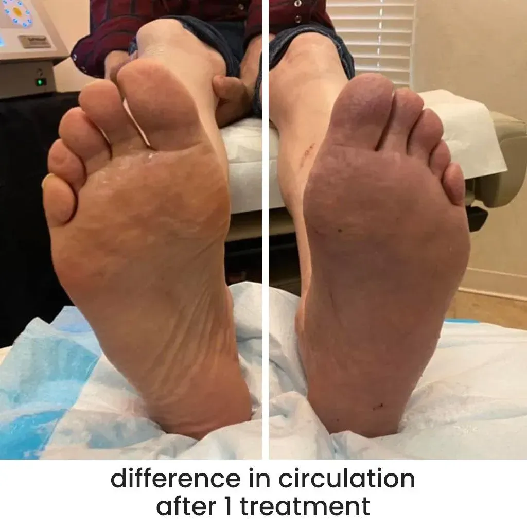 Difference in circulation