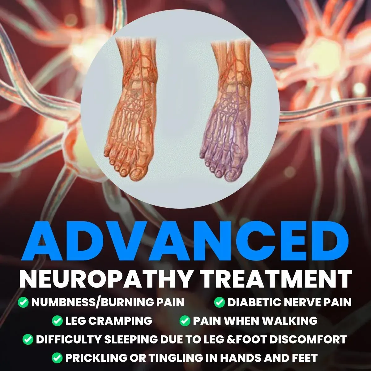 Advanced Neuropathy Treatment