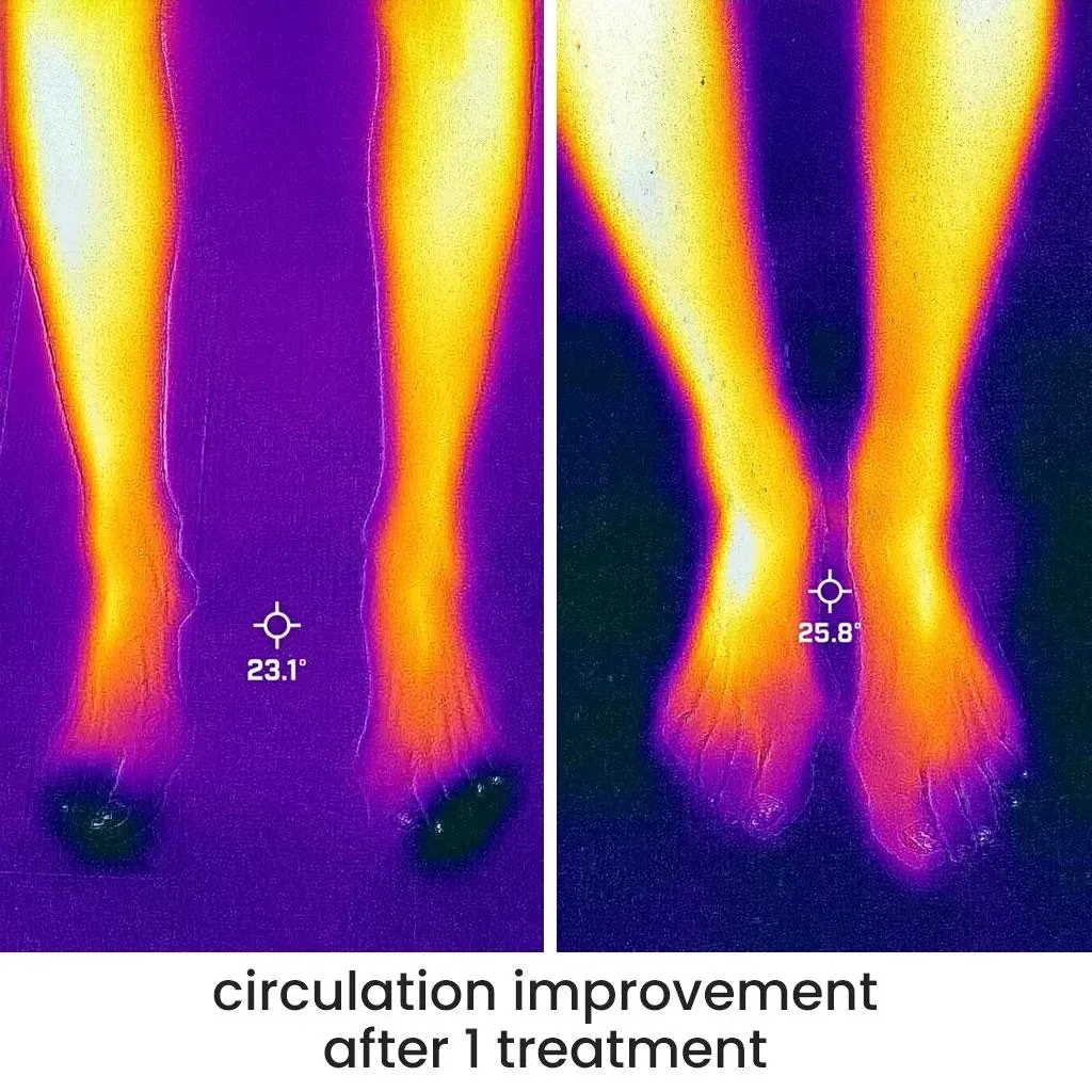 Circulation improvement