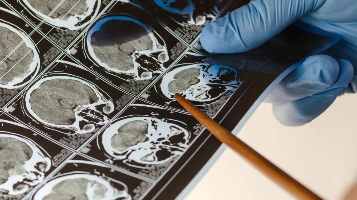 Back Surgeon in Plano Texas