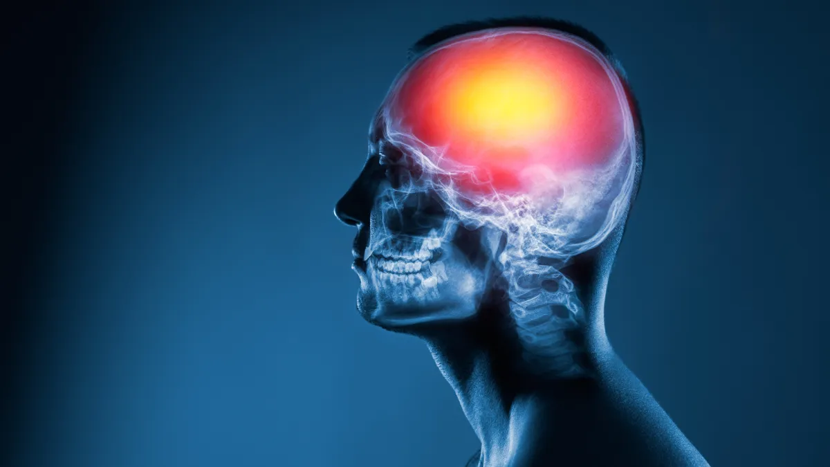 Brain decompression surgery specialist The Colony TX