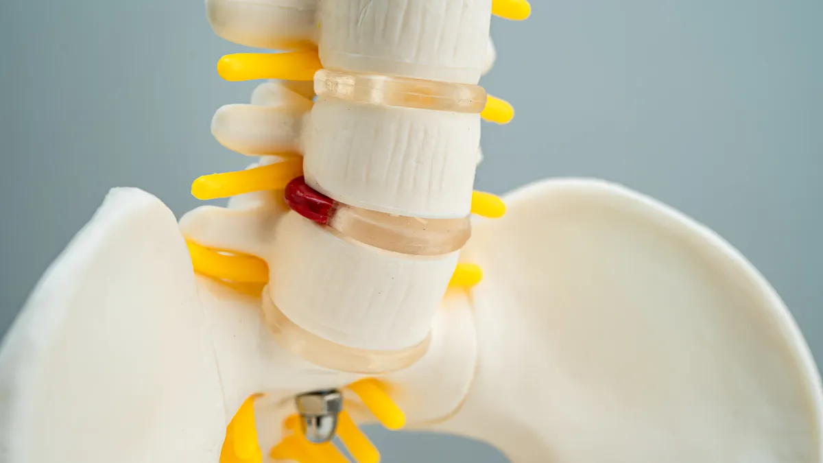 Spine surgery solutions for degenerative disc disease at a premier spine clinic Plano TX