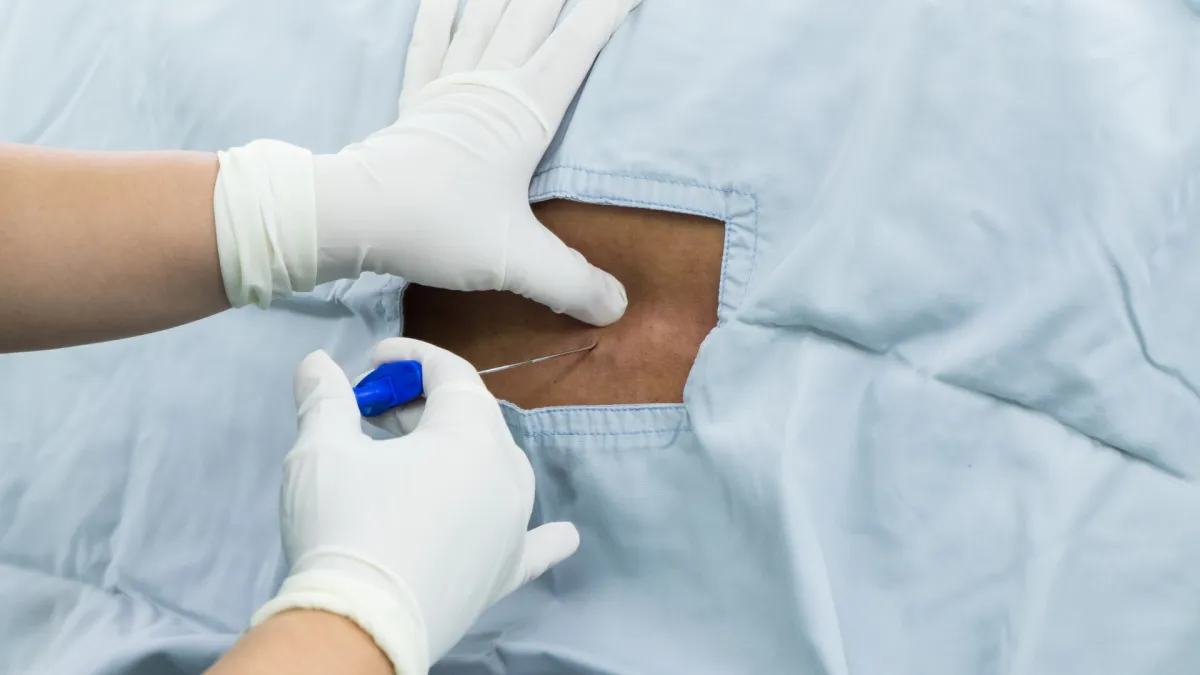 Alternatives to spinal fusion spine surgery Plano TX