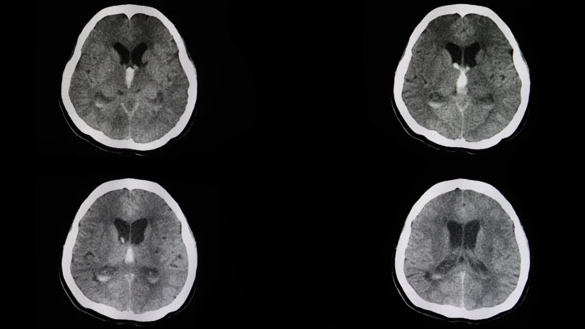 Lewisville TX spine surgeon expert