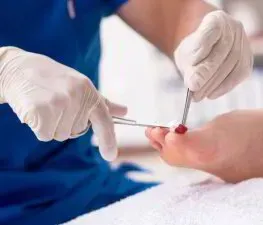 Nail Surgery for Ingrown Toenails in Knowle