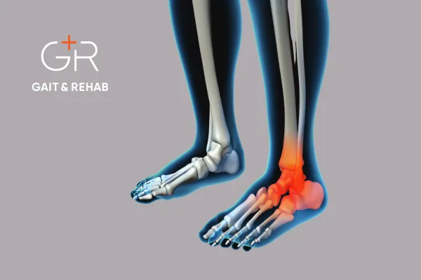 Image of a painful ankle