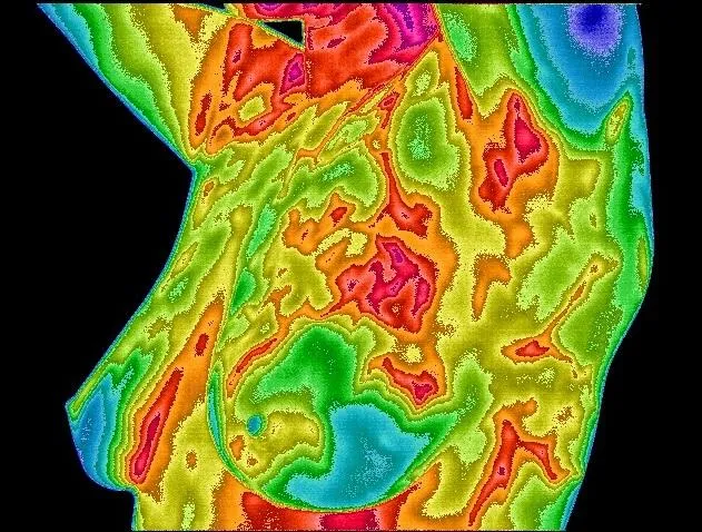 Thermography vs. Mammograms: What Every Woman Needs to Know