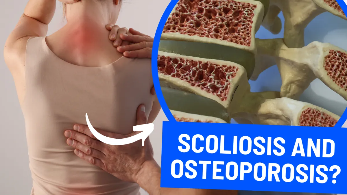 Exploring the Connection Between Scoliosis and Osteoporosis