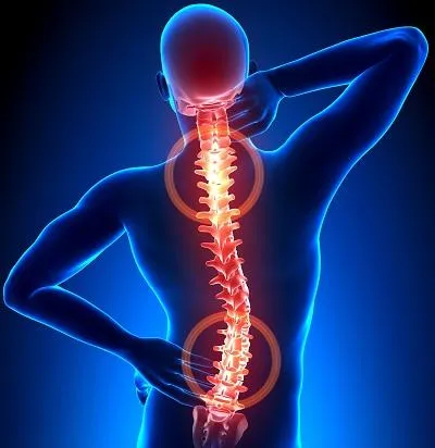 Is it possible to reverse scoliosis without bracing or surgery?