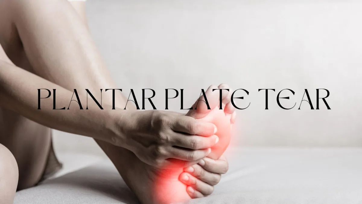 Plantar Plate Tear- Peak Podiatry
