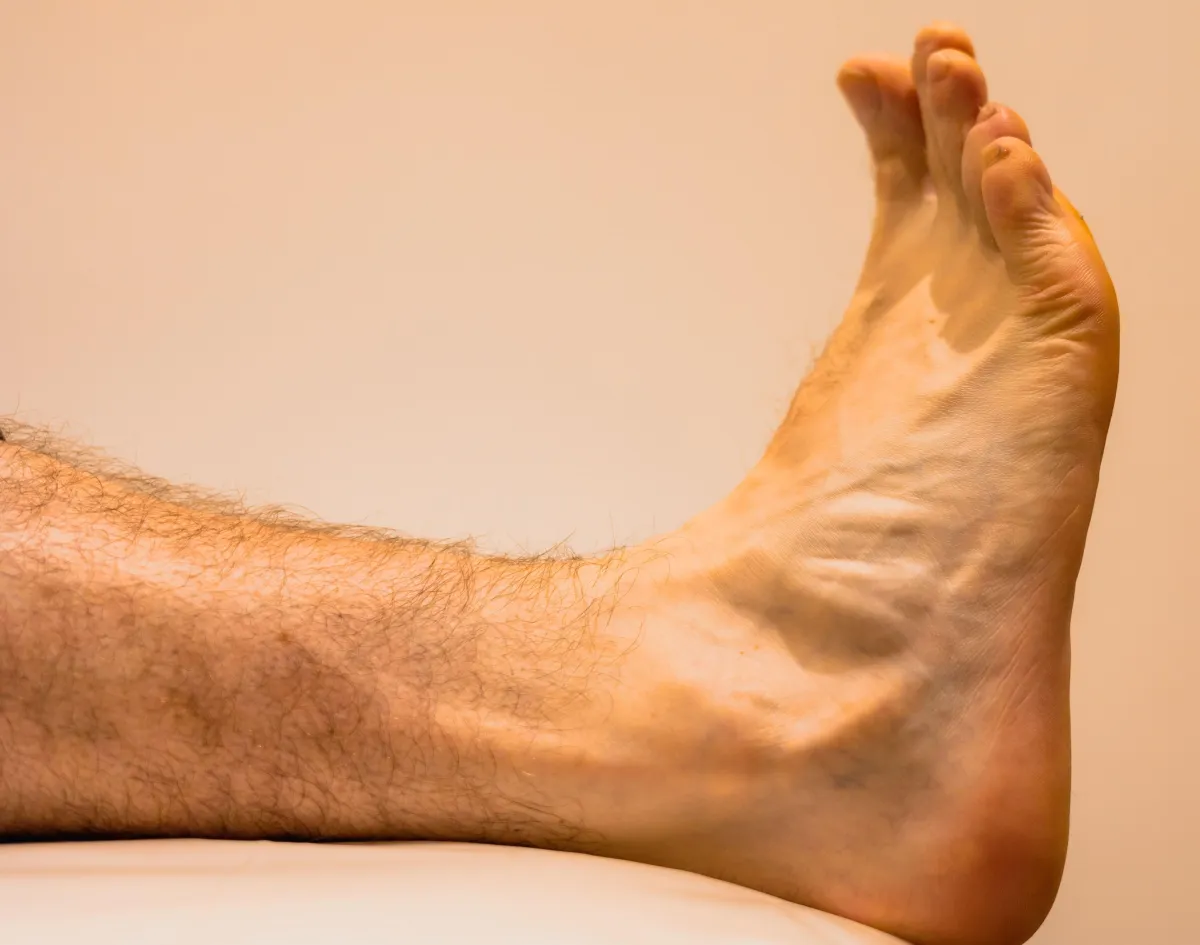 Arch Support Insoles For Flat Feet