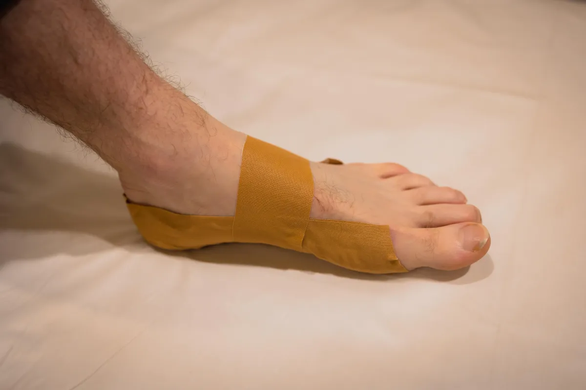 At home strapping for plantar fasciitis 