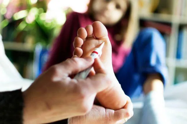 verruca feet
