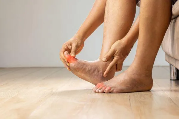 swollen feet