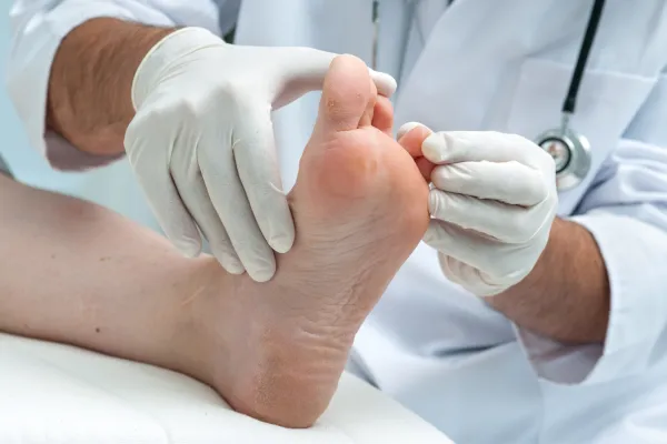 The Best Ways to Treat and Prevent Athlete’s Foot