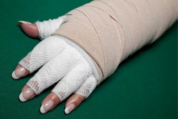 Lymphedema