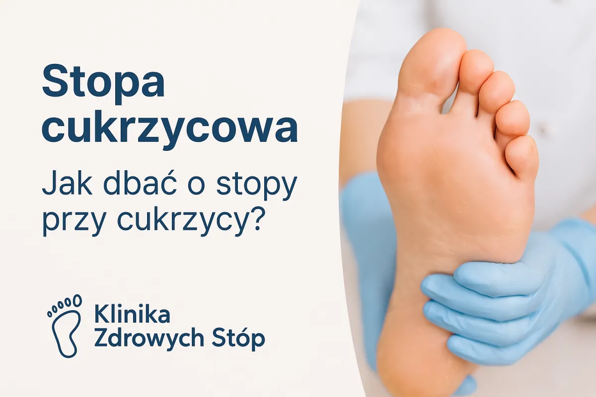 Stopa cukrzycowa – jak chronić stopy przy cukrzycy? | Podolog Płock