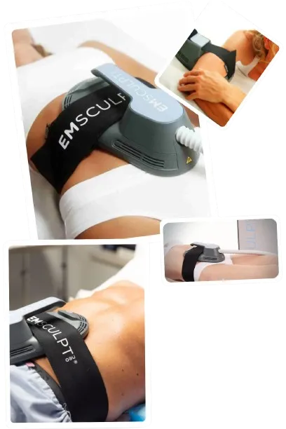 Emsculpt Neo in Beverly Hills