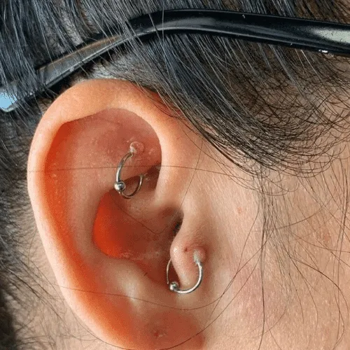 Piercing Bumps?