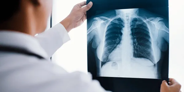 Are Chiropractic X-Rays Safe?