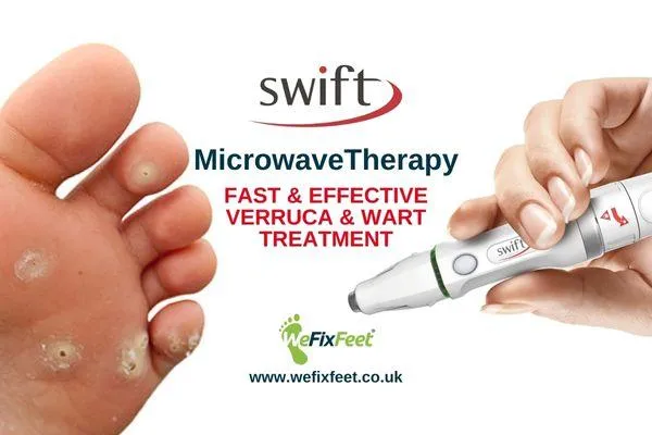 verruca microwave treatment