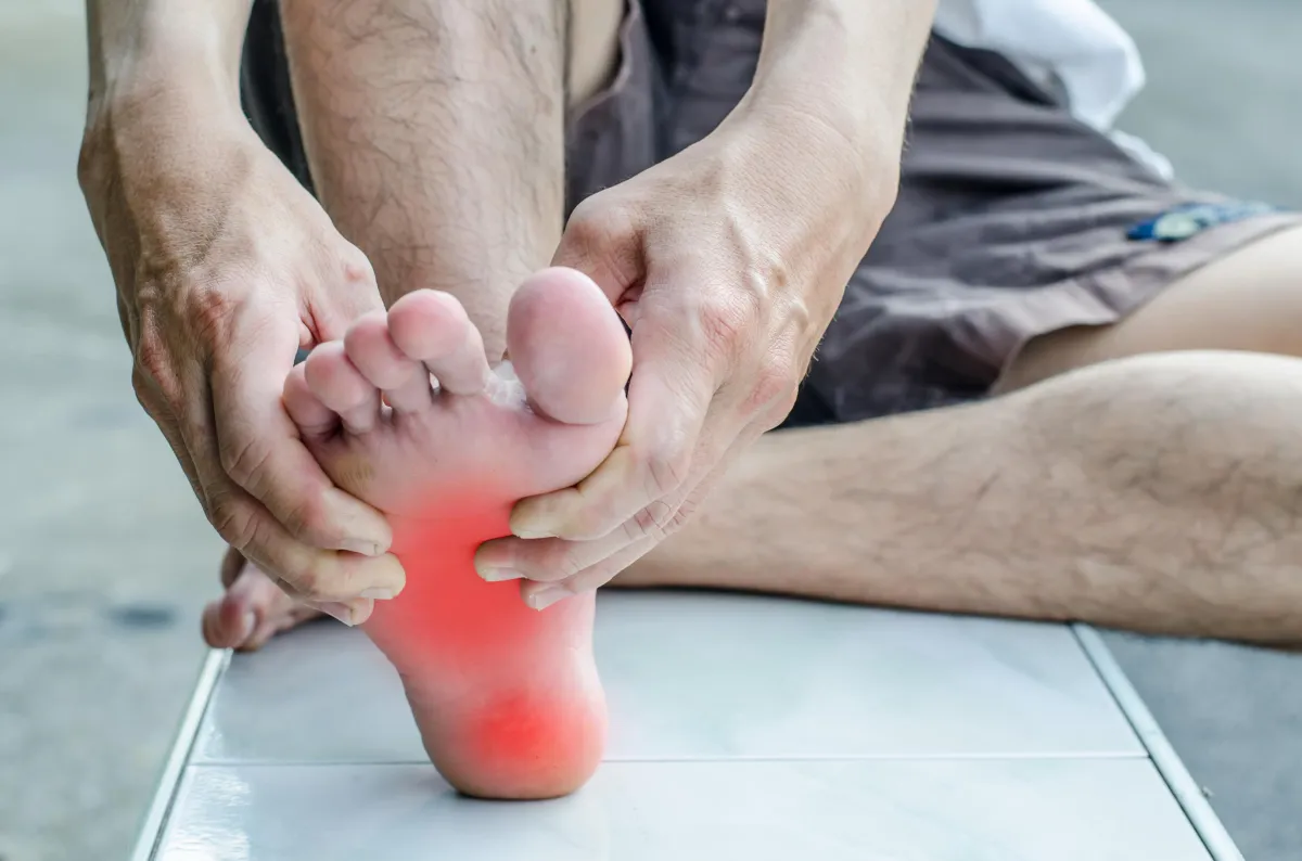 Plantar Fasciitis foot pain. We Fix Feet, Clinics in Beeston and Ilkeston.