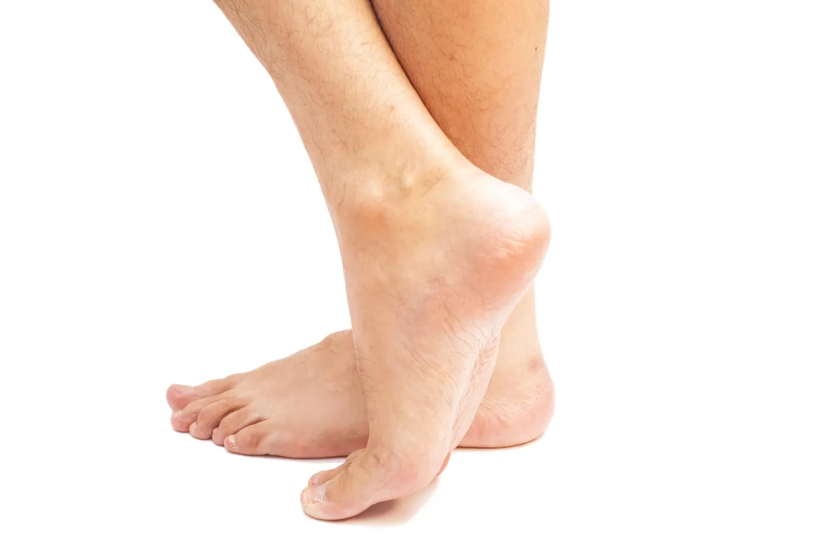 Feet and heel pain. We Fix Feet, Ilkeston and Beeston