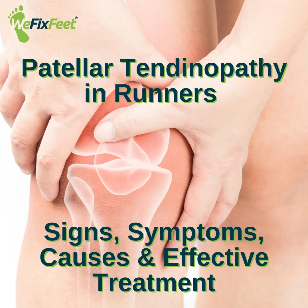 Patellar pain. We Fix Feet, Beeston and Ilkeston.