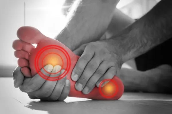 Intractable Plantar Keratoma: Do You Feel Like You Are Walking With a Rock Stuck In Your Foot?