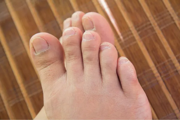 The Top 7 Foot Problems We See in Central Florida—and How We Treat Them