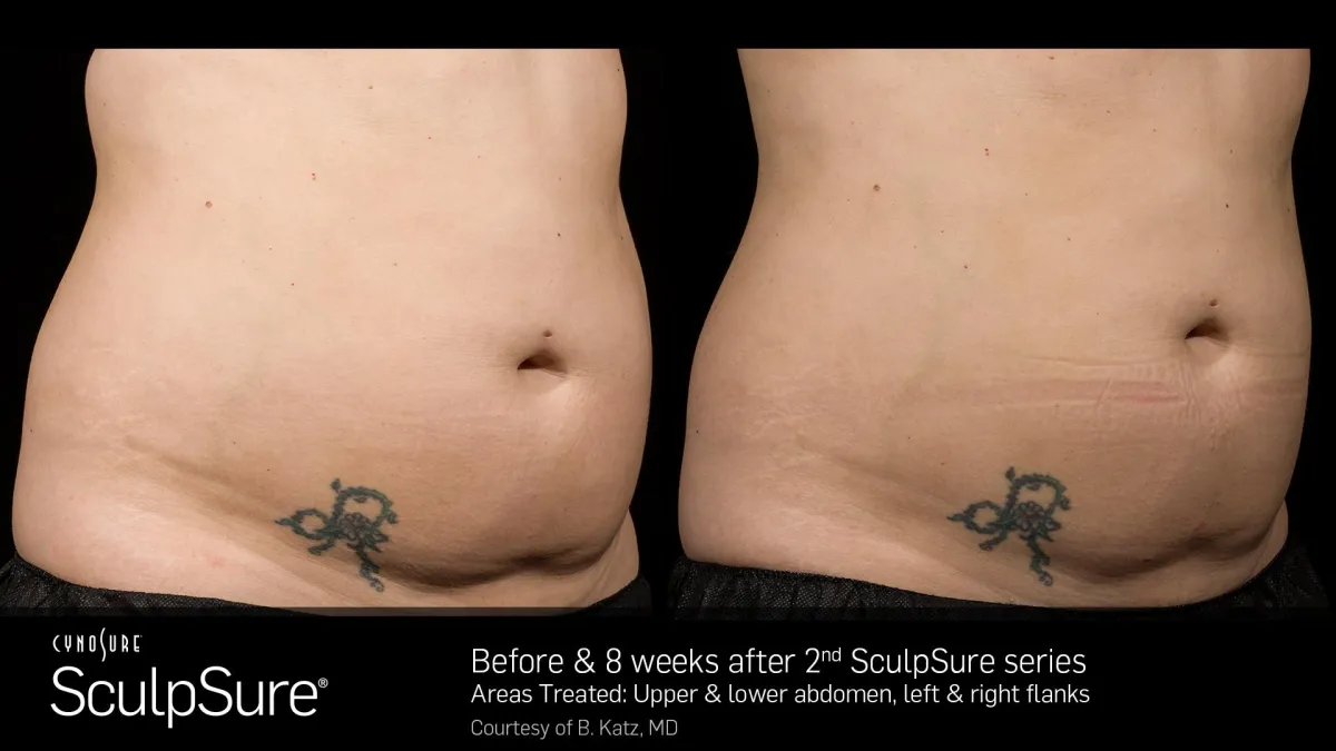  best weight loss center near me