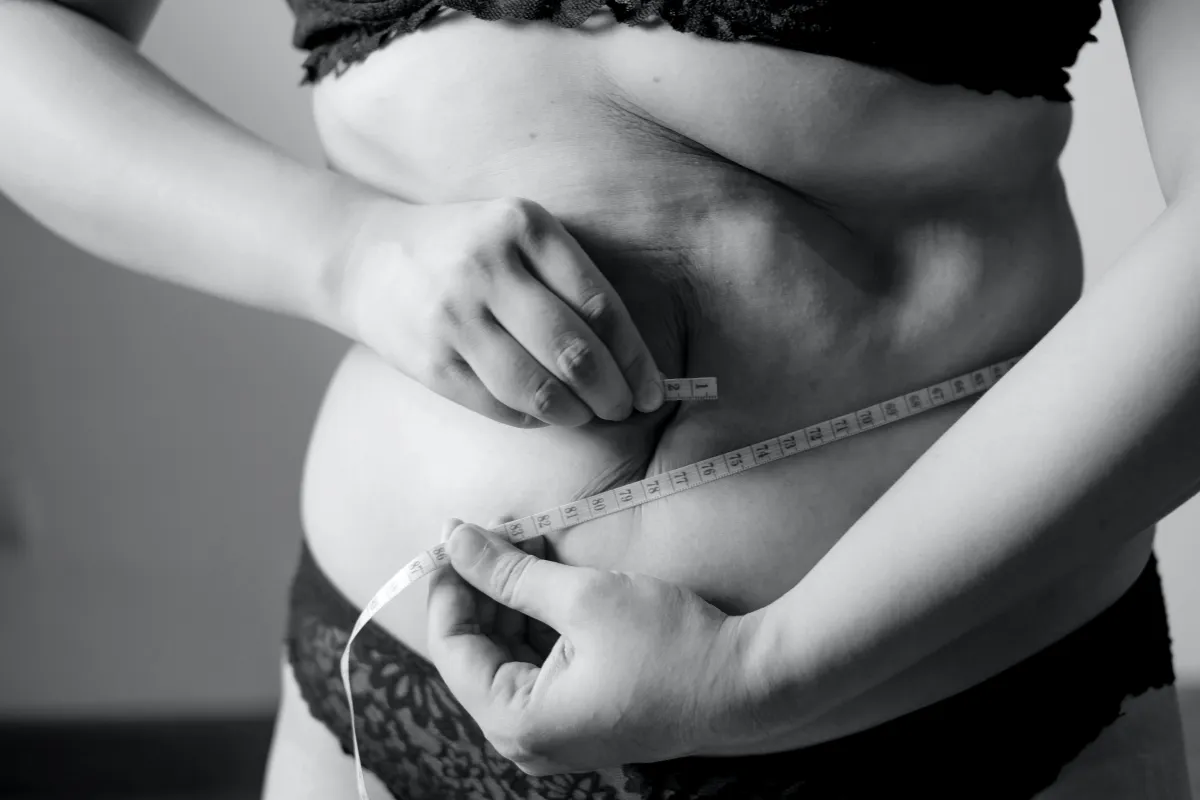 HCG weigh loss jersey city, transformative health 