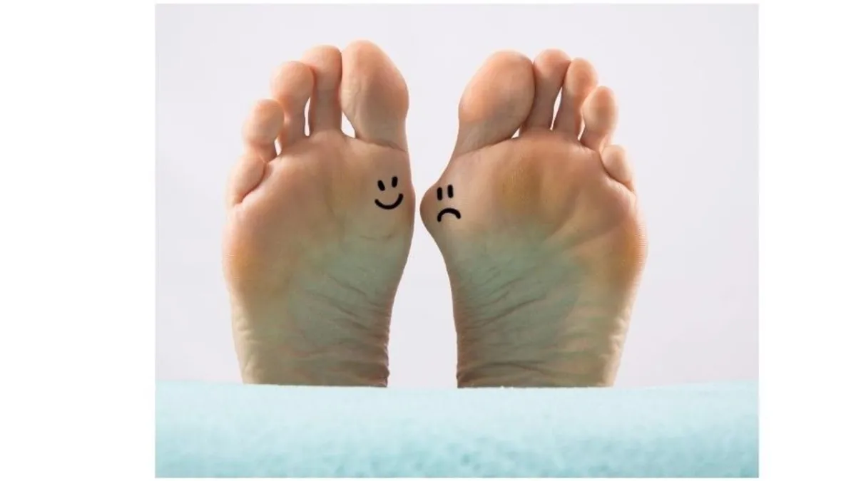 Bunions- How to Avoid Surgery!