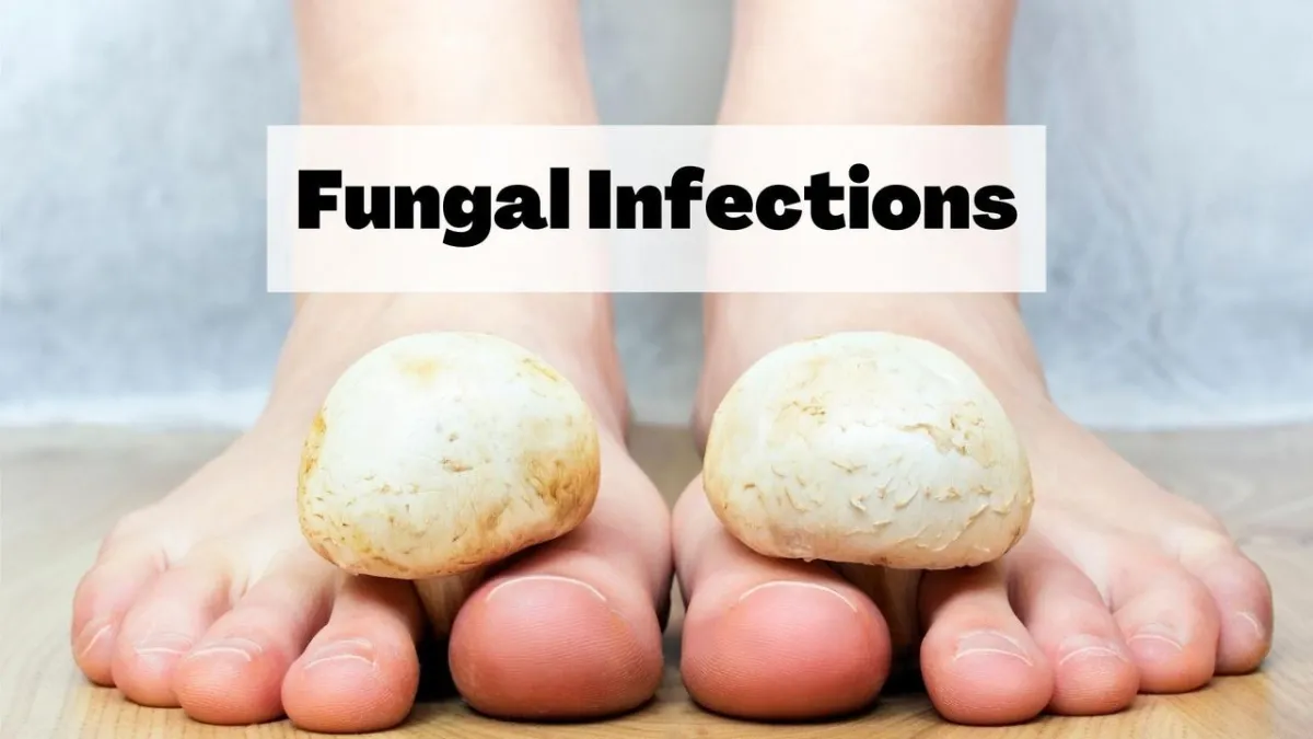 Fungal NailsThe Lacuna Method