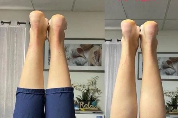 Corrective Muscle Balance Therapy: Your Path to Symmetry and Relief